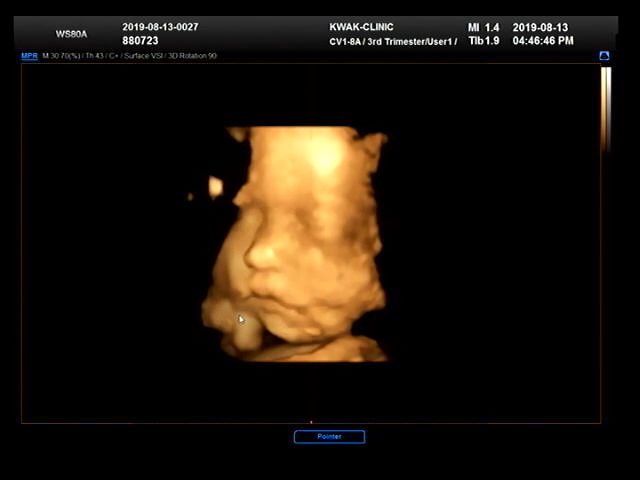 [임신후기 8개월] 28주 : 3D 입체초음파로 행복이 얼굴보고 온 날 (@곽여성병원)