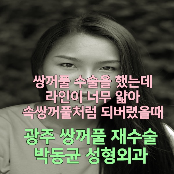  광주쌍수 재수술