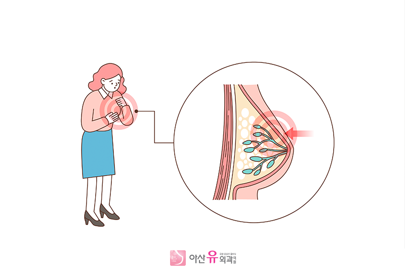 젖몸살  유방염증 유선염인데 수유해도