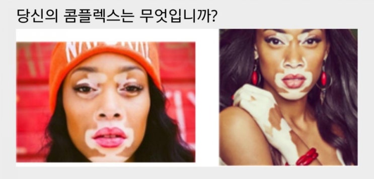  당신의 콤플렉스는 무엇입니까?