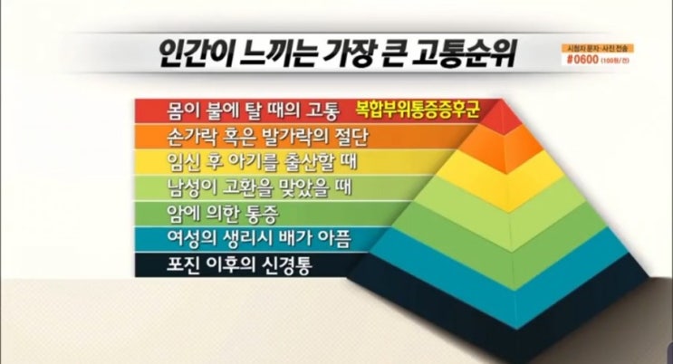  가장 중요한 것은 '의료진에 대한 신뢰'/복합부위통증증후군(CRPS)
