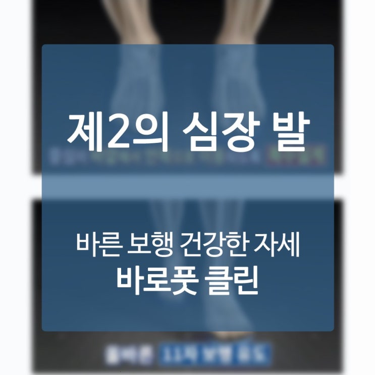  교정용깔창 분명히 초월한 성취 사연