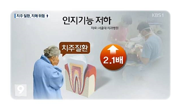  라이나치과보험임플란트 꿀팁대공개