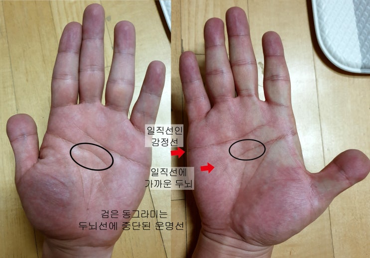  막장을 향해 달리는 손금