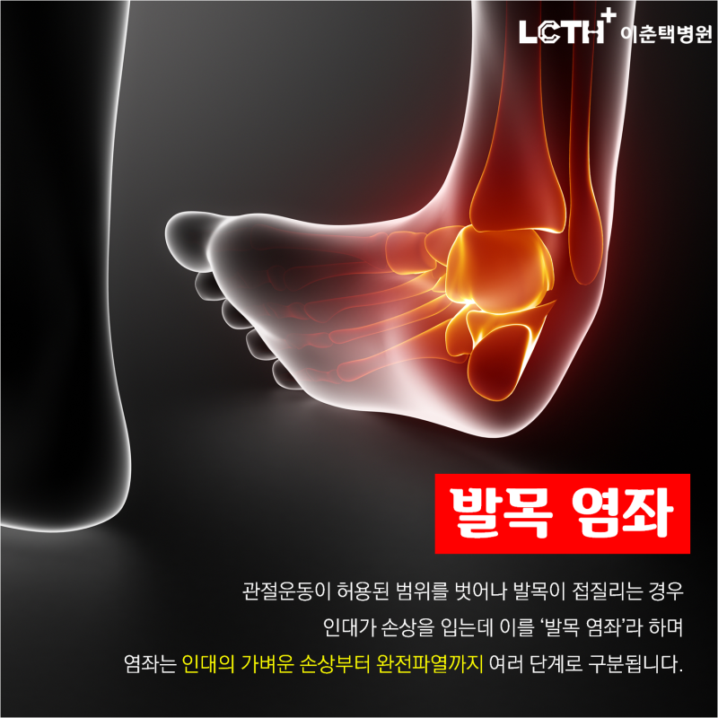 발목 인대 치료 방법은 어떻게 이뤄질까. 4