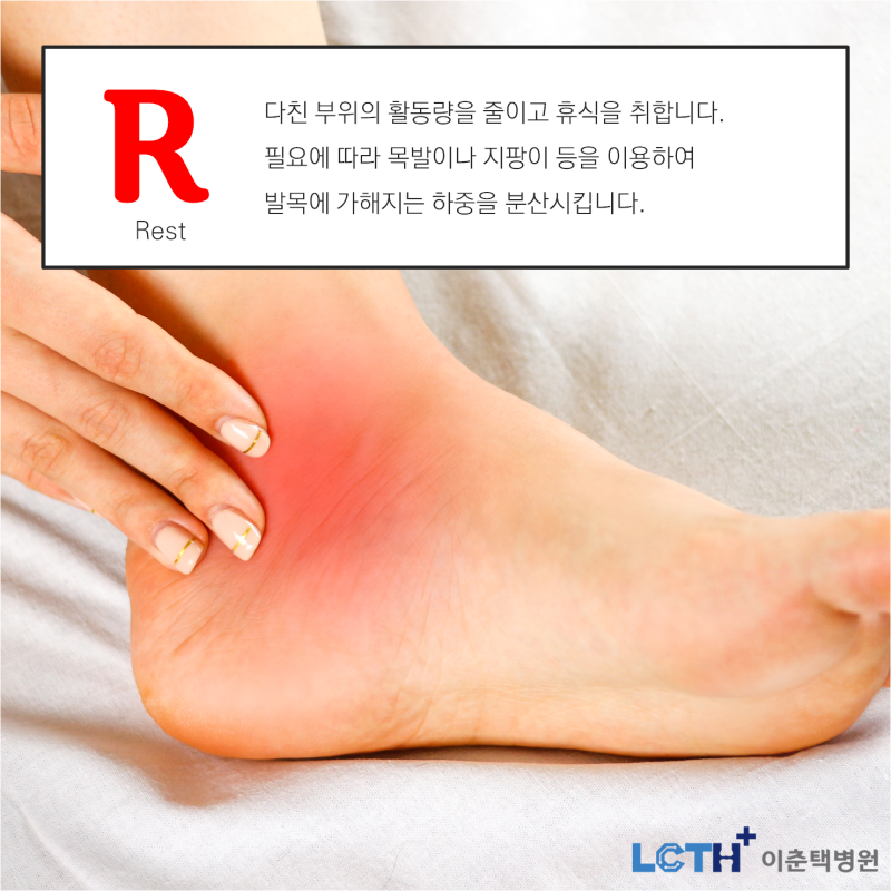발목인대가 늘어났을 때 파열 확인, 증상 및 부러졌을 때 대처방법(feat. 발목염좌, 발목불안정증) 2