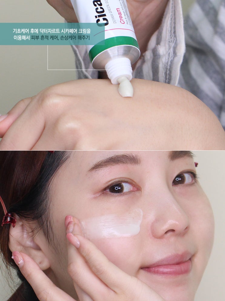  닥터자르트 시카페어 크림 :: 여드름흔적 케어하는 팁 방출
