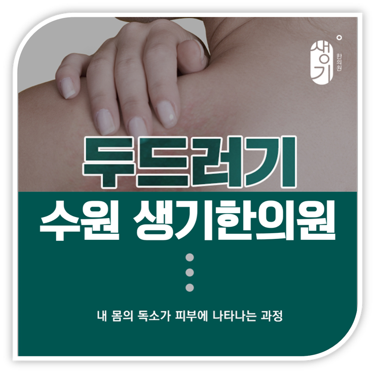 수원두드러기 가려움 밤에 더 심해요