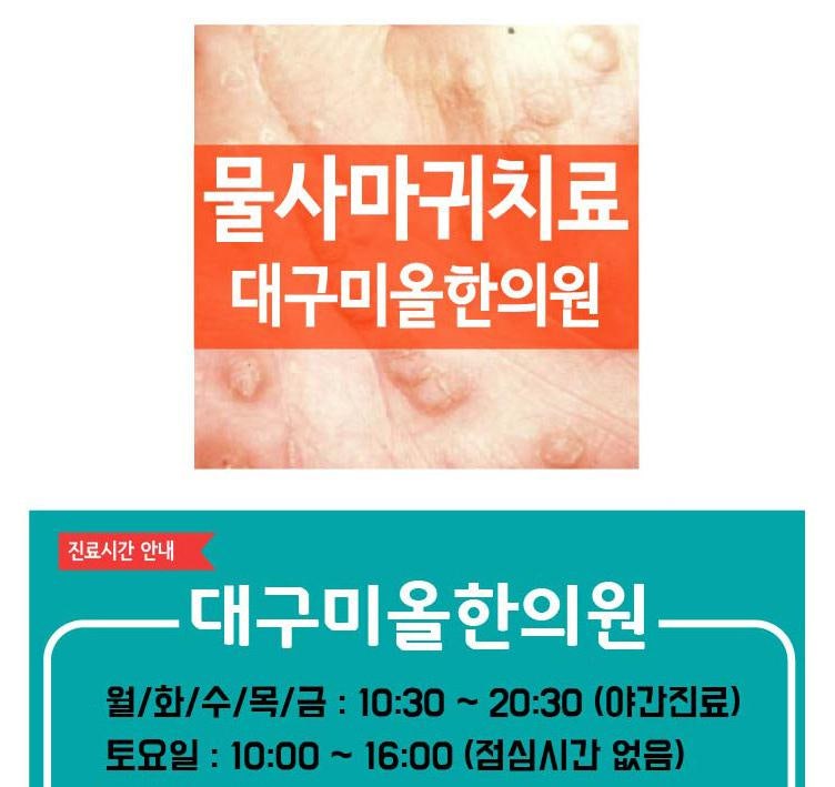 대구편평사마귀 한의원 스스로 밀어내도록
