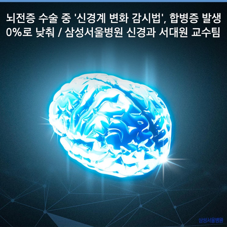  뇌전증 수술 중 '신경계 변화 감시법', 합병증 발생 0%로 낮춰 / 삼성서울병원 신경과 서대원 교수 연구팀