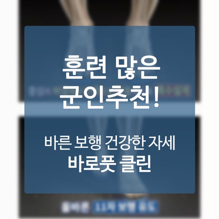  족적근막염신발 돌파하기 위한 완전정벌 전략안