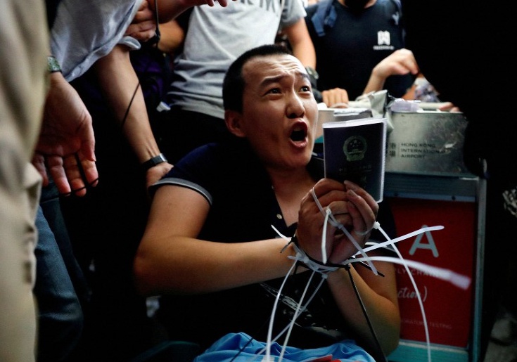 홍콩 공항에서 중국 환추 인터넷 기자 폭행을 당한 부상