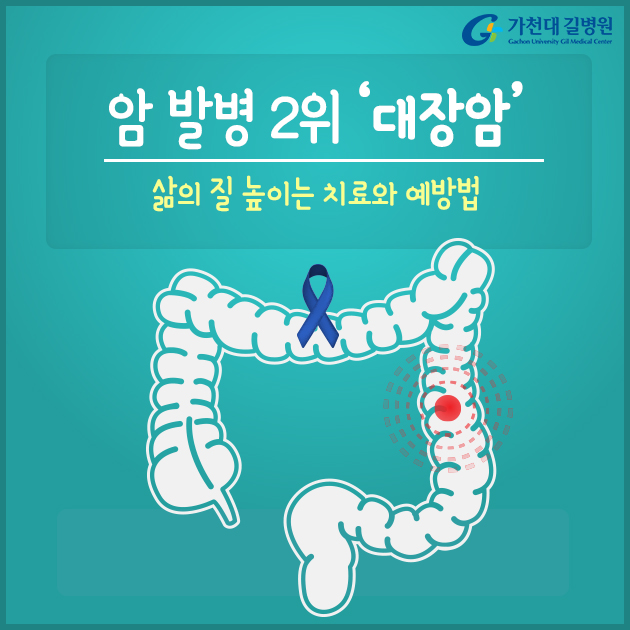  암 발병 2위 ‘대장암’, 삶의 질 높이는 치료와 예방법