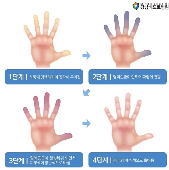 레이노병