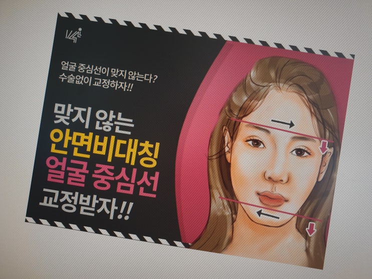  일산안면비대칭 교정후기 살펴보니, 걱정이 한결 덜어지네요!