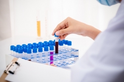  바이오사, R&D 예산 중 인건비 투자 집중...최대 300억원 지출 - 약사신문