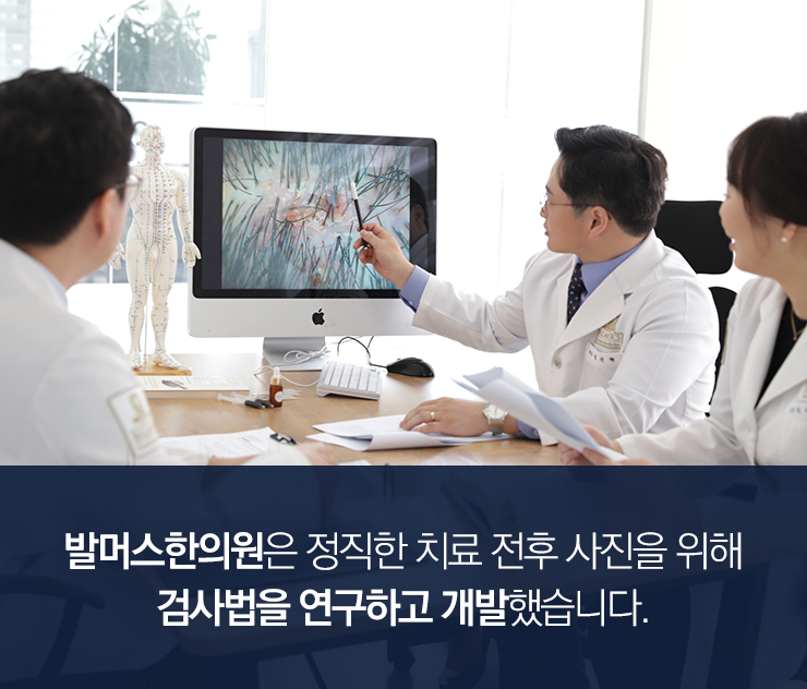 두피열 치료 전, 알아둬야 할 사항은?
