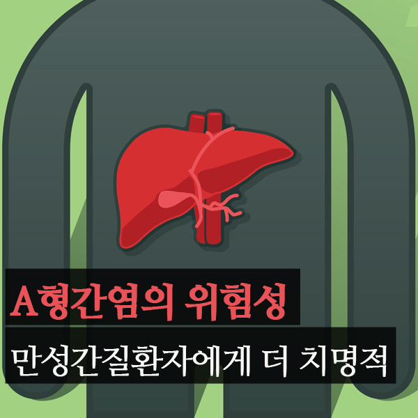  A형간염의 위험성 만성간질환자에게 더 치명적