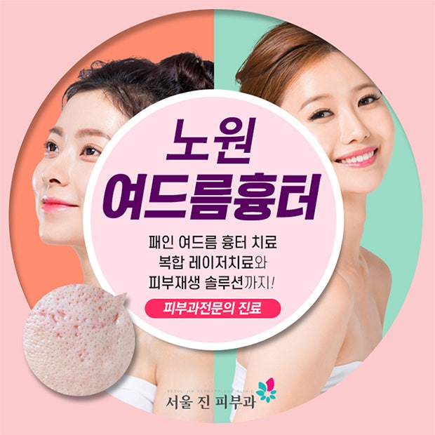 서울피부과에서 여드름 증상 치료하는 방법 알아보기