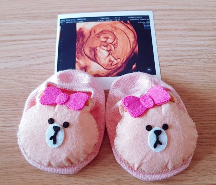 21편 "태교시작~!" 21편 "태교시작~!"
