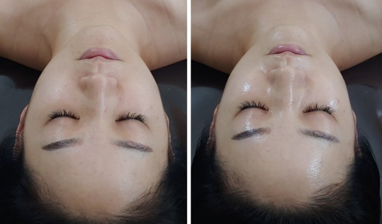  [운정피부관리] 피부상태 콕콕 찝어 관리해주는 이상화콕콕테라피 산내마을 마사지 수기관리샵