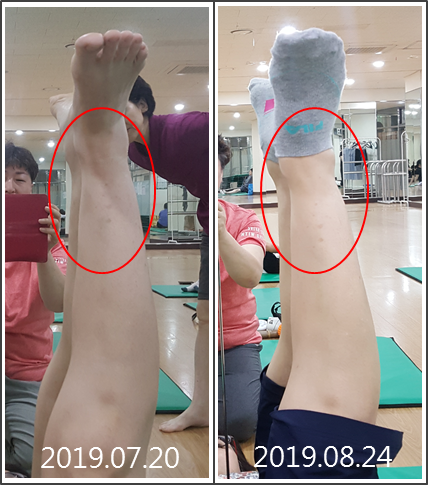  송파여성문화회관 체형&셀프통증관리교실