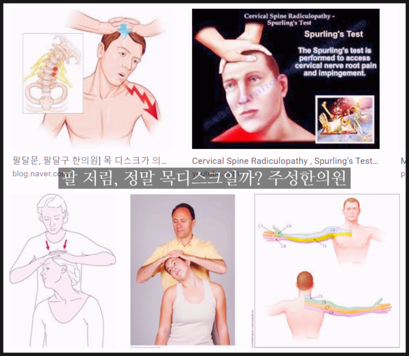 목디스크팔저림 추나요법으로 관리한다면