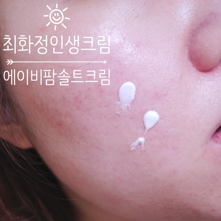  수분부족형지성/ 트러블피부 이신 분들 주목 최화정인생크림 [에이비팜솔트크림]으로 피부 좋~다는 소리한번 들어보자 !!