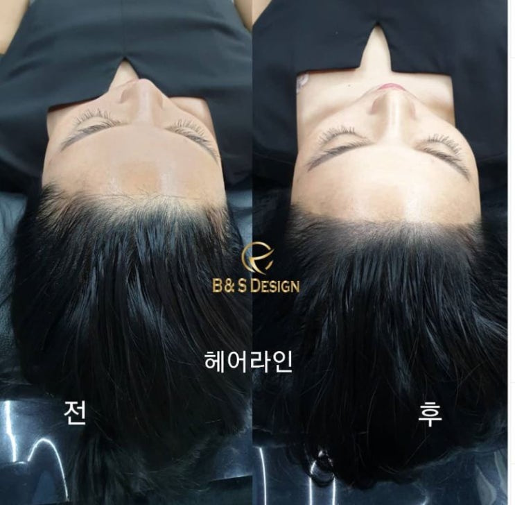 청주헤어라인문신,정수리문신,가르마문신,b&s design