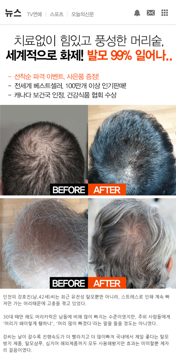  빠지는 모발... 고민 많으셨다구요!? 그럼 이 내용을 주목 하세요!