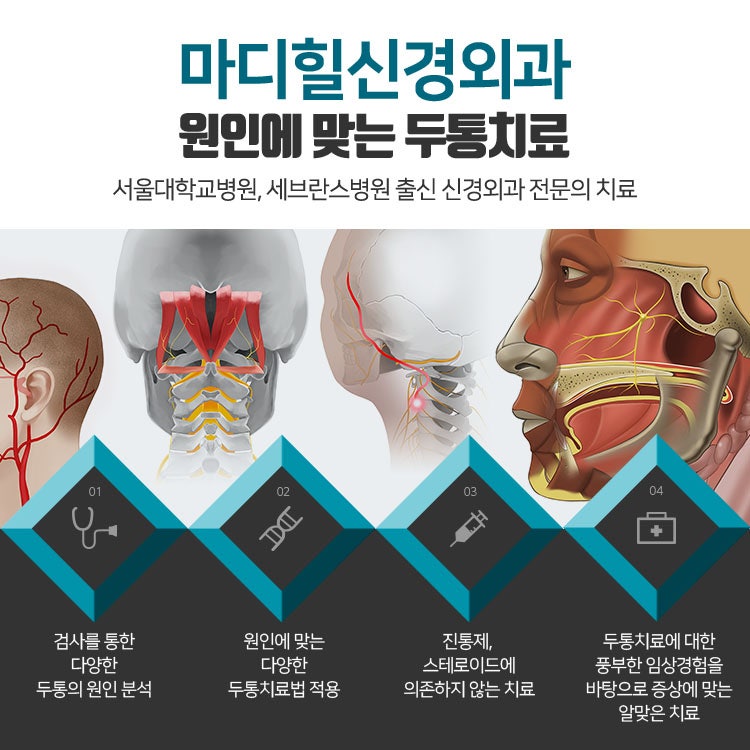 왼쪽 머리아픔, 어떤 두통을 겪고 있을까??