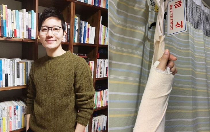  김정근 아나, 팔 부상 입고도 긍정 마인드 "손가락 움직여 감사"