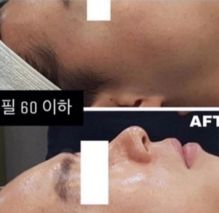  에스테틱 다이아몬드광채필링 샵에서? NO! 이제집에서 홈케어관리! 더마셀럽 하이필키트로 다이아몬드광채필링하세요