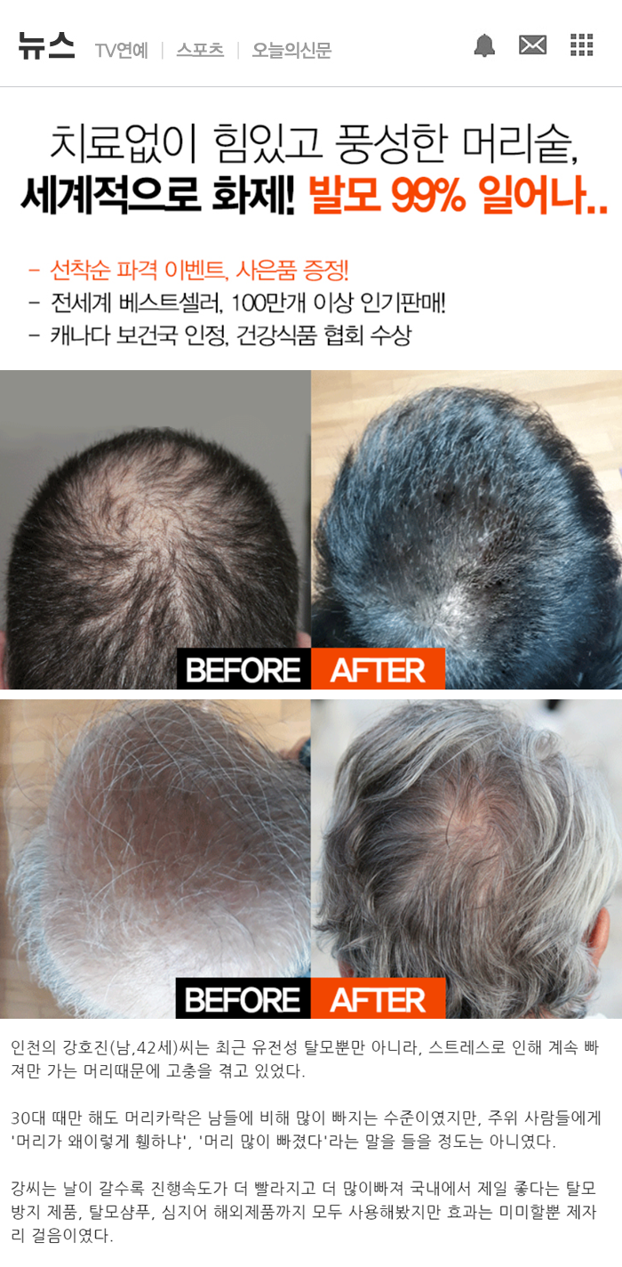  평소 탈모 때문에 스트레스받고 계신분들 이 내용을 주목해보세요!