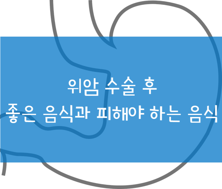  위암 수술 후 좋은 음식과 피해야 하는 음식