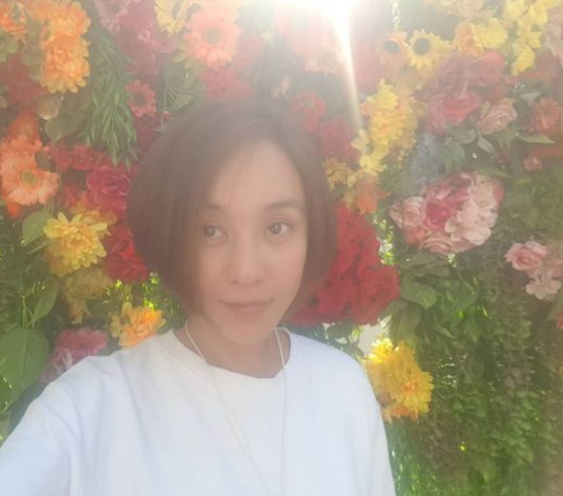  권민중 "지난 6월 얼굴에 화상…기적적으로 많이 나았다" [입장 전문]