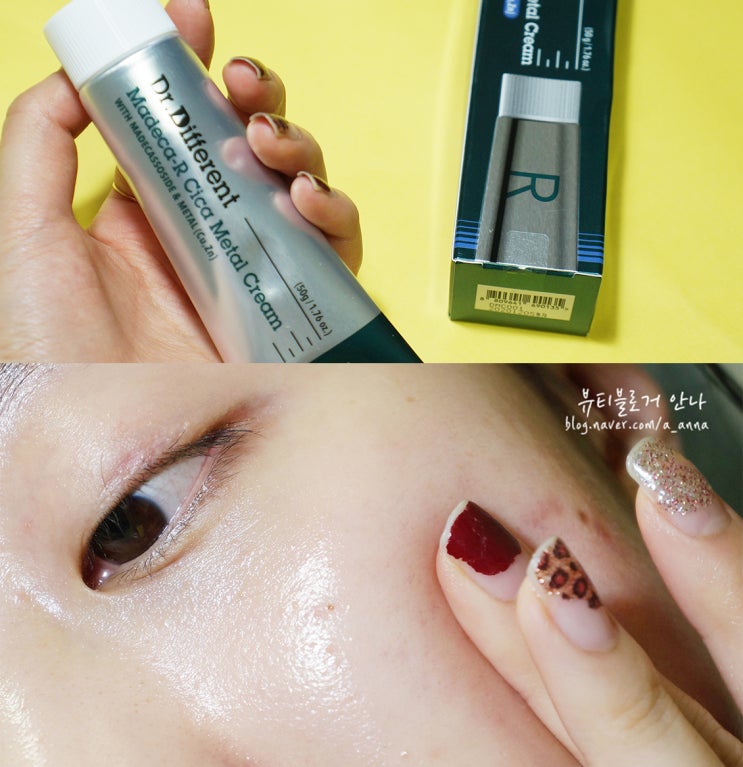  닥터디퍼런트 마데카크림 애프터 바캉스 피부 진정했지