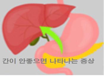  간이 안좋으면 나타나는 증상 요약 설명