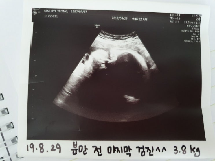  39주5일. 단국대병원 유도분만결정!!!