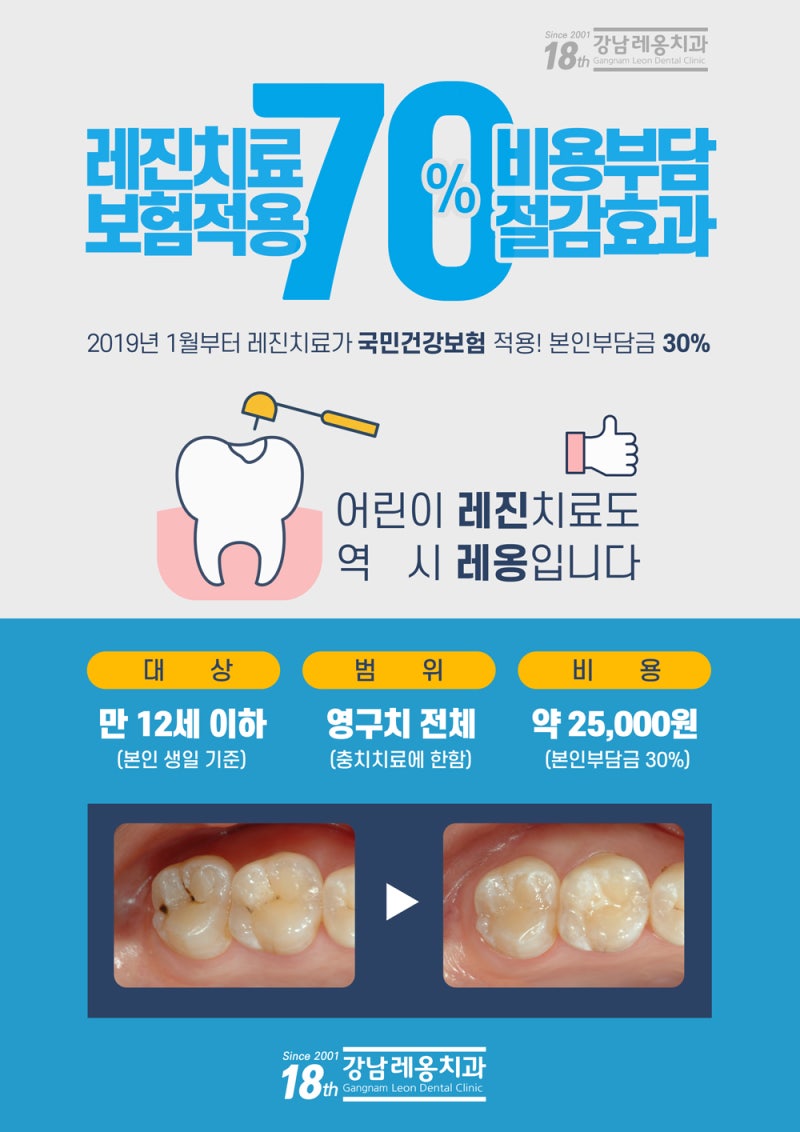 치아레진비용 초기치료가 중요합니다 7
