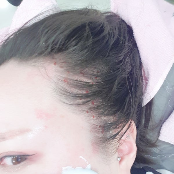 내돈내산 슈링크 에어젯 얼굴 리프팅 2