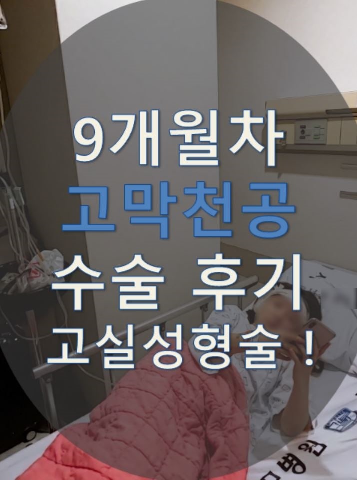 9개월차 고막천공수술 그 후...[고막천공수술,고막패치술,고실성형술]