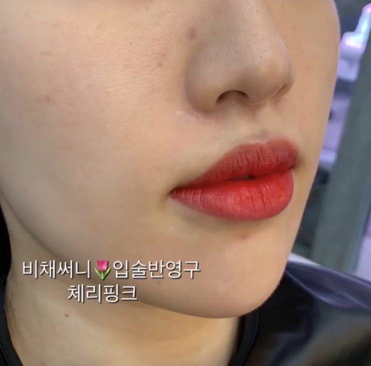  대구여신입술문신탈각 리얼후기 입꼬리올리기 동성로비채뷰티