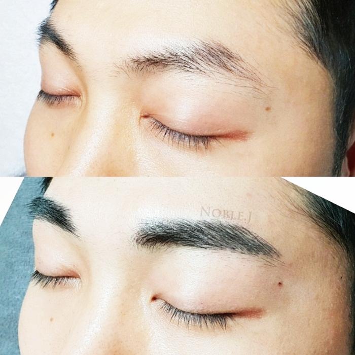 등촌동 헤어라인 고민하고 있다면 여기에 주목!  