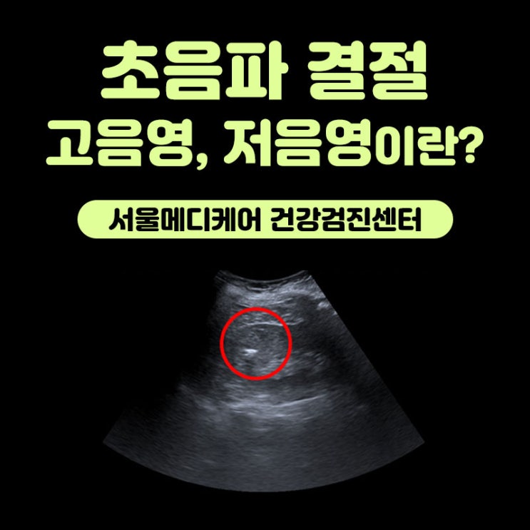  초음파 결절 고음영 저음영 - 서울메디케어 건강검진센터