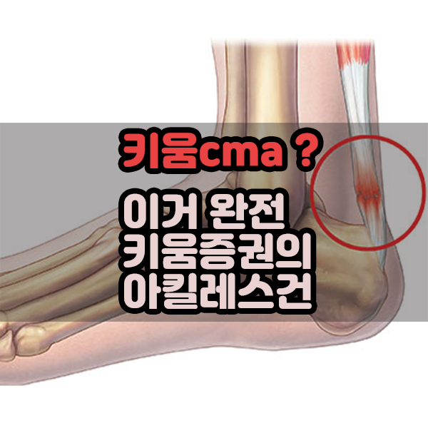  키움CMA? 이거 완전 키움증권의 아킬레스건