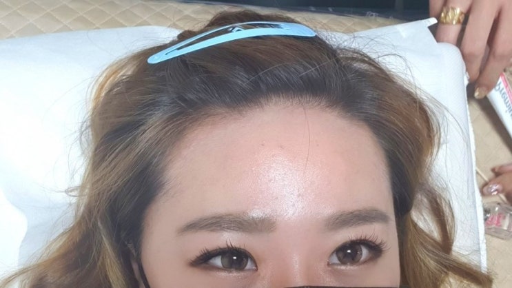  헤어라인 반영구로 동글동글 이쁜이마  만들기~!!