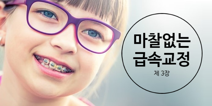 교정을 빠르게 하는 방법 세번째 - Frictionless orthodontics 마찰이 없는(적은) 급속교정