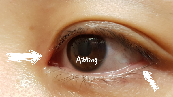 눈 다래끼 결막염 안연고 안약 네오덱스 /일본 항균안약