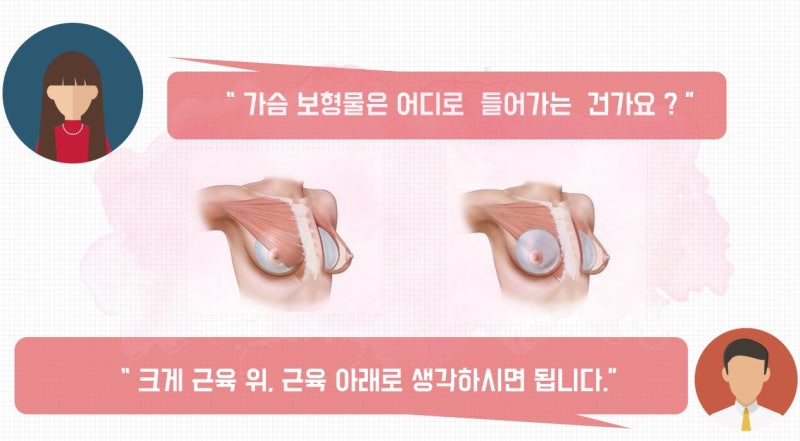 코셀성형외과 > 유방성형수술 후 수유시간 (가슴수술통증?) 2